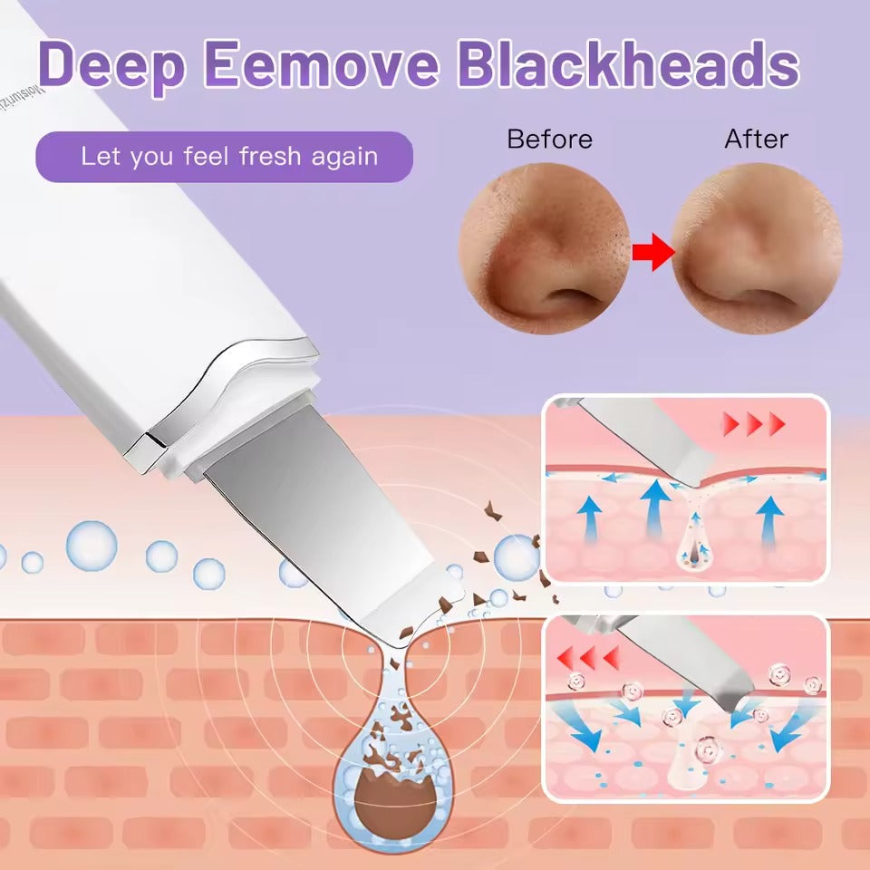 Ultrasonic Skin Scrubber – Deep Facial Cleansing & Lifting Tool