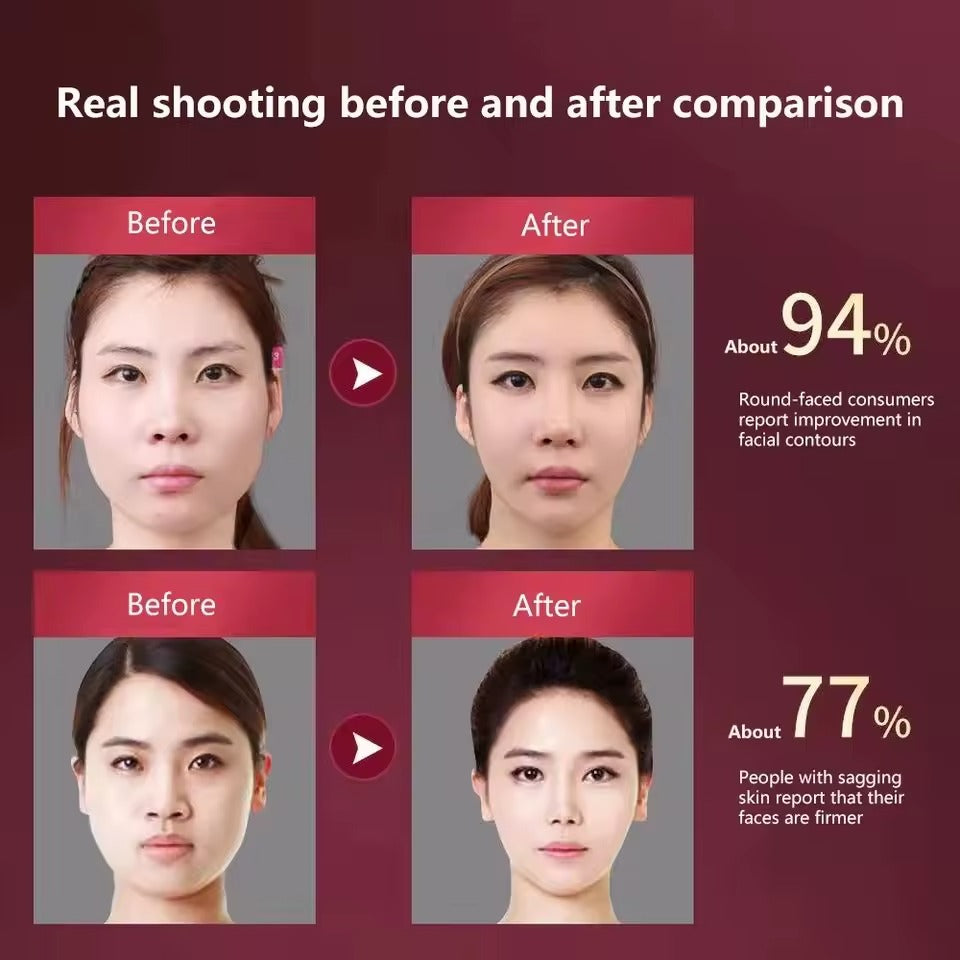 V-Lift LED Facial Massager – Slim, Lift & Glow in One Smart Device