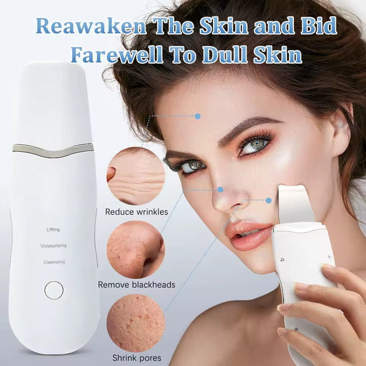 Ultrasonic Skin Scrubber – Deep Facial Cleansing & Lifting Tool