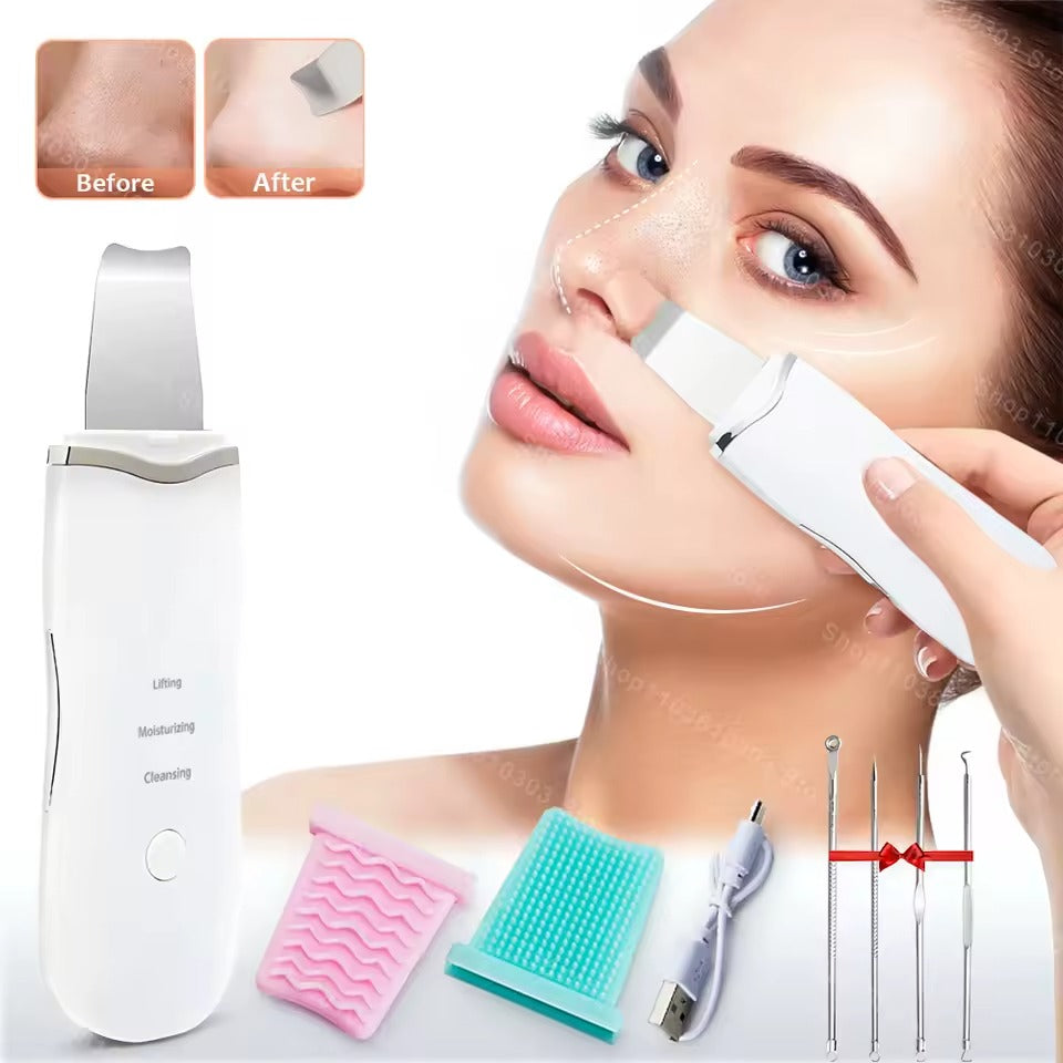 Ultrasonic Skin Scrubber – Deep Facial Cleansing & Lifting Tool