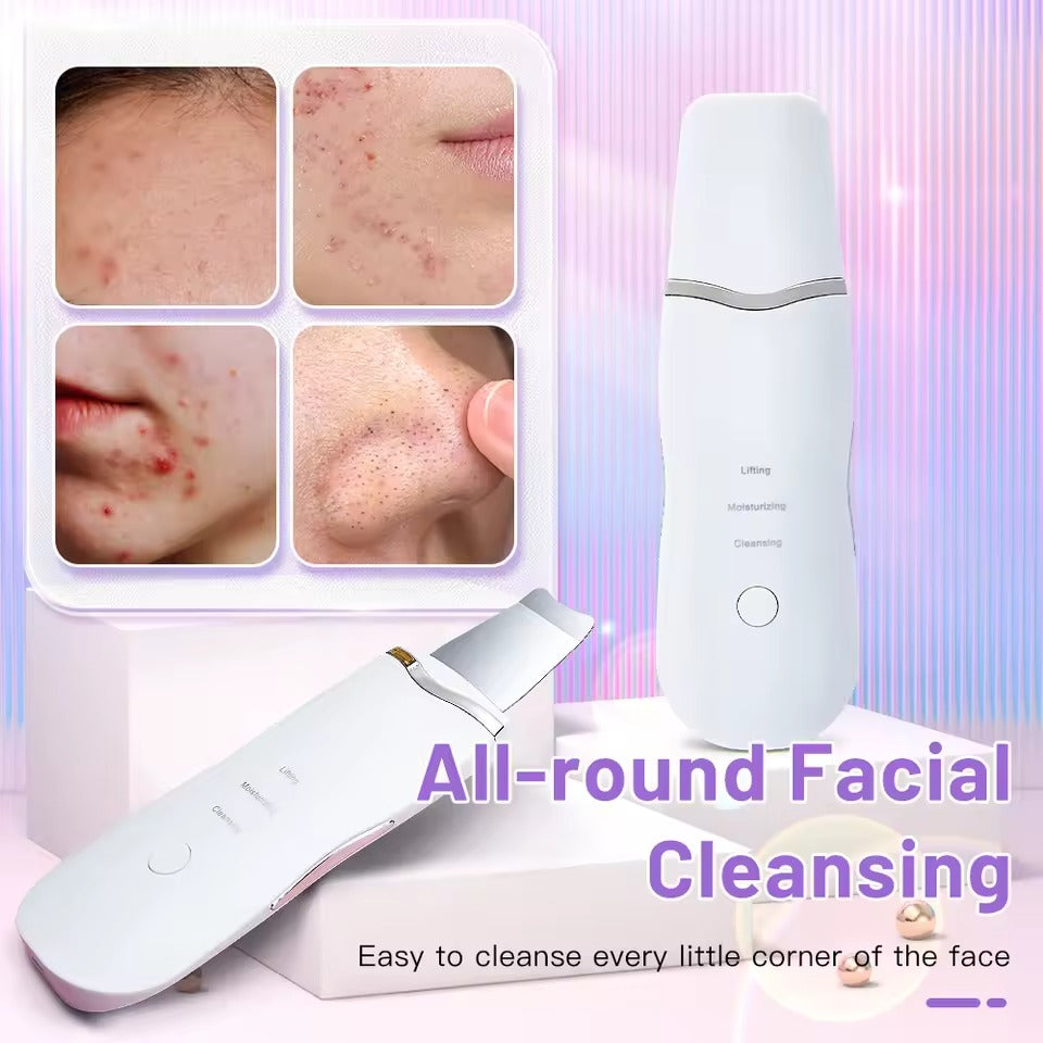 Ultrasonic Skin Scrubber – Deep Facial Cleansing & Lifting Tool